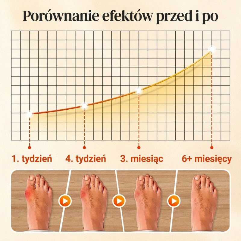 🔥Gorąca promocja🔥Unisex niewidoczne skarpetki korekcyjne z pięcioma palcami