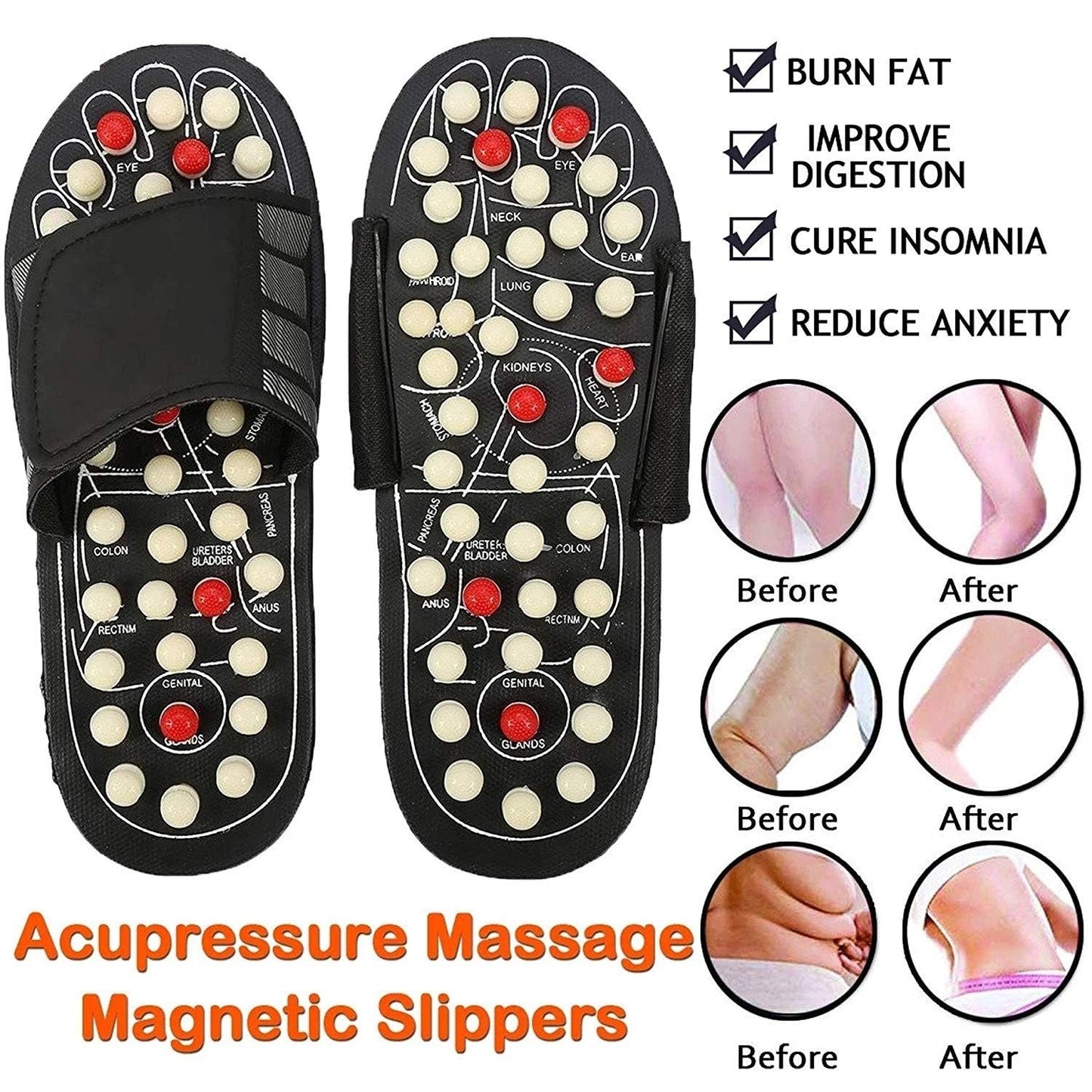 Kapcie do akupresury i terapii magnetycznej 🔥50% ZNIŻKI!🔥