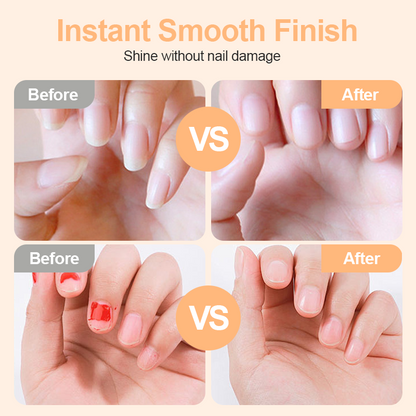 🧑‍🎄Świąteczna oferta specjalna-Bezpieczny elektryczny obcinacz do paznokci 2 w 1