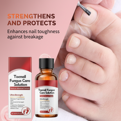 🔥Wielka wyprzedaż –50% taniej!🔥🖤Zobacz szybsze efekty🖤2 opakowania serum regenerującego do zniszczonych paznokci💅🏻