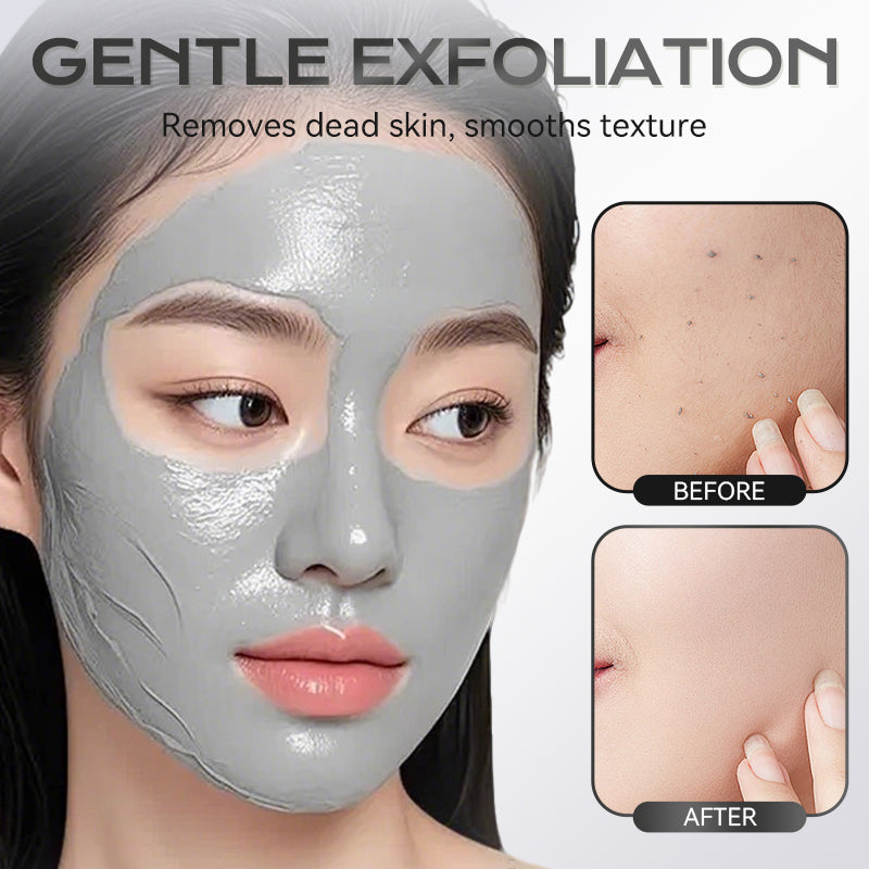 ✨ Pożegnaj się z chaosem związanym z maseczkami — paleta maseczek glinkowych z kwasem azelainowym! ✨