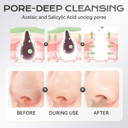 ✨ Pożegnaj się z chaosem związanym z maseczkami — paleta maseczek glinkowych z kwasem azelainowym! ✨