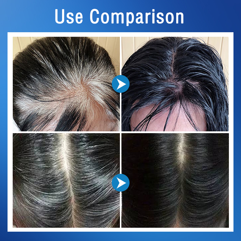 ✨ Farba do włosów 3 w 1 z grzebieniem — łatwa, szybka i delikatna, zapewnia komfortowe farbowanie włosów w domu! ✨