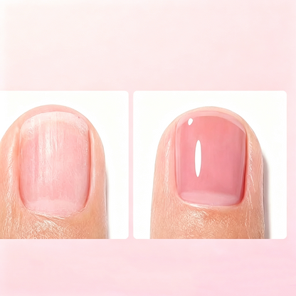 💅 Wzmacniacz paznokci z białkiem mleka – 50% ZNIŻKI! KUP 1 → 1 GRATIS!🛡️💖OFERTA LIMITOWANA!Profesjonalna formuła – wzmacnia, odżywia i chroni łamliwe, rozdwajające się paznokcie.Regularne stosowanie przynosi widoczne efekty już po kilku dniach! ✨